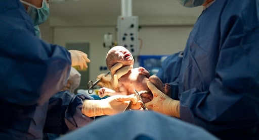 Erin Marshall Law | The Long-Term Impact Of Birth Injuries On Children And Families